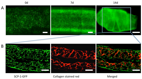 如何使用低成本桌面3D打印機創(chuàng)建血管結(jié)構(gòu) 如何使用低成本桌面3D打印機創(chuàng)建血管結(jié)構(gòu)